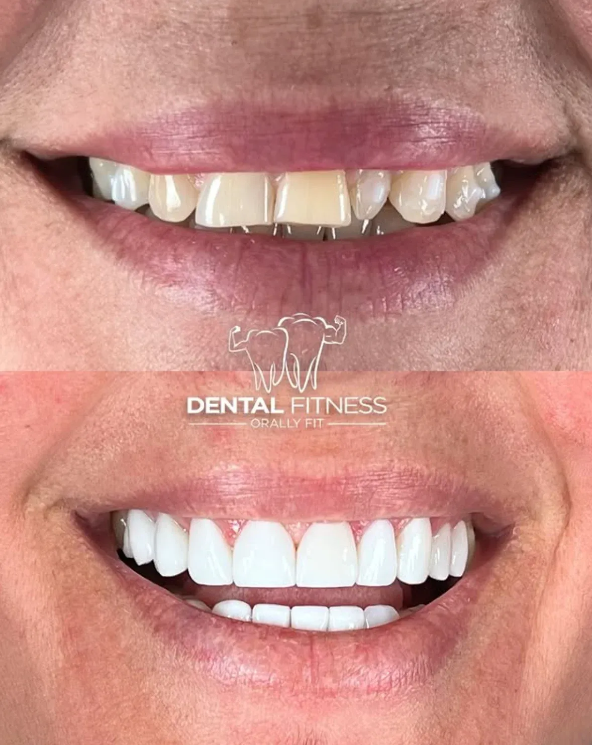 Healthy Smile Transformation (1)