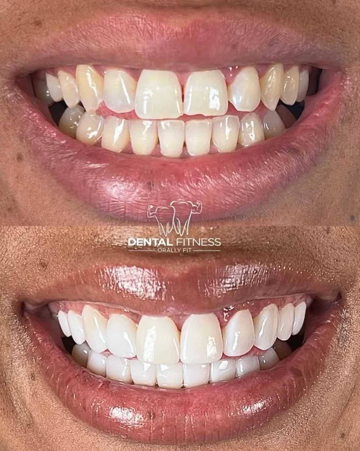 Healthy Smile Transformation (2)