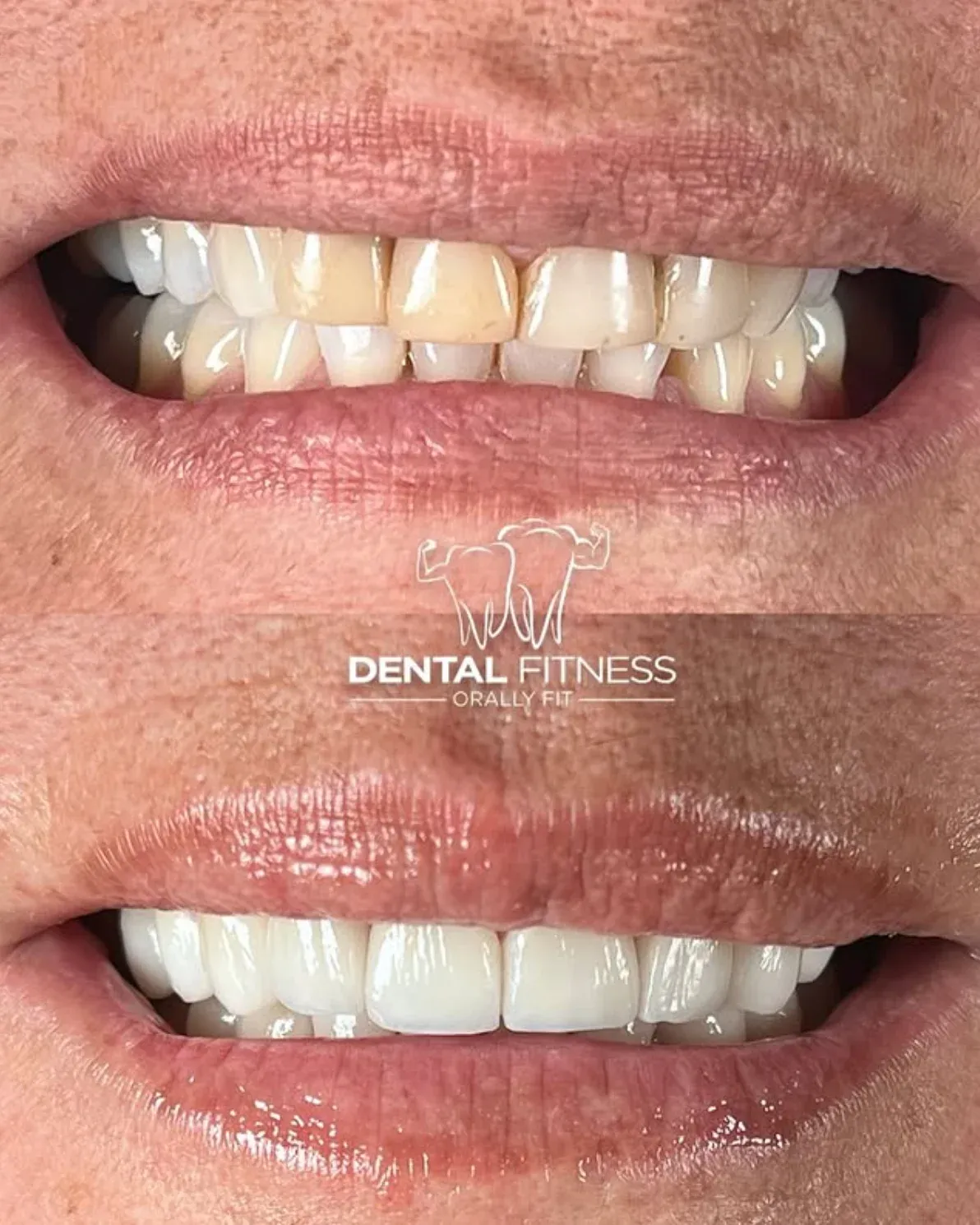 Healthy Smile Transformation (3)