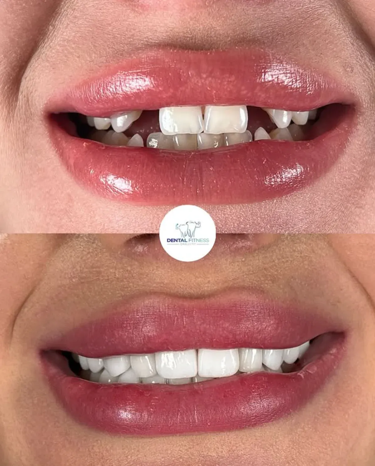 Healthy Smile Transformation (4)