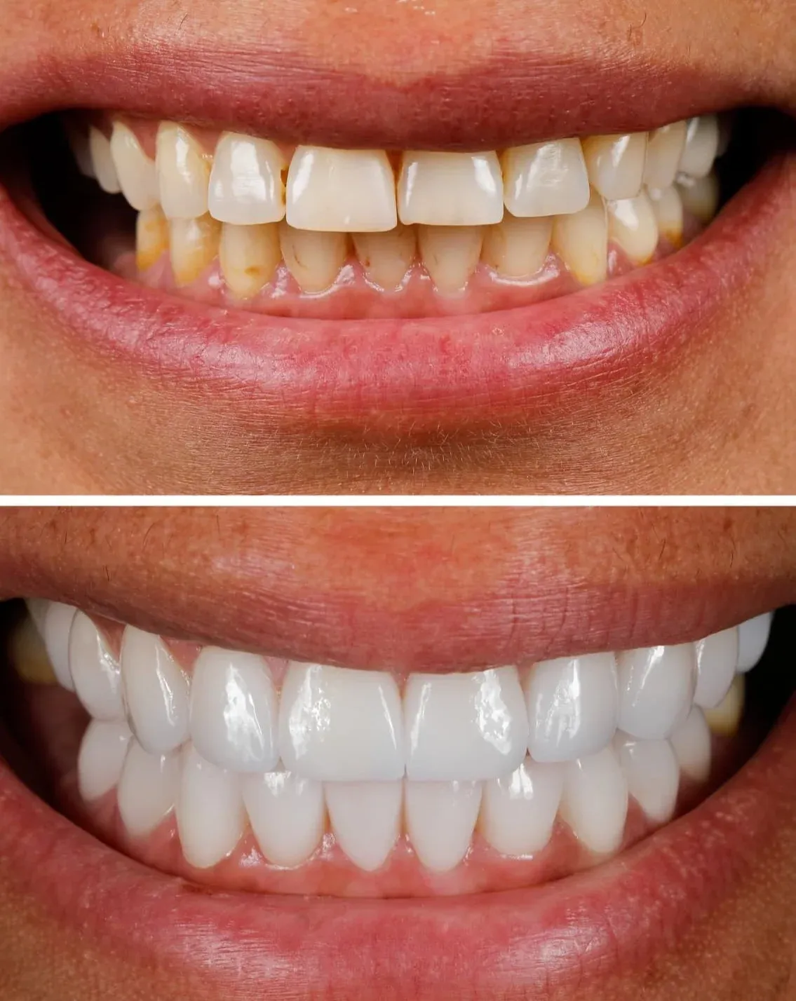 Healthy Smile Transformation (6)