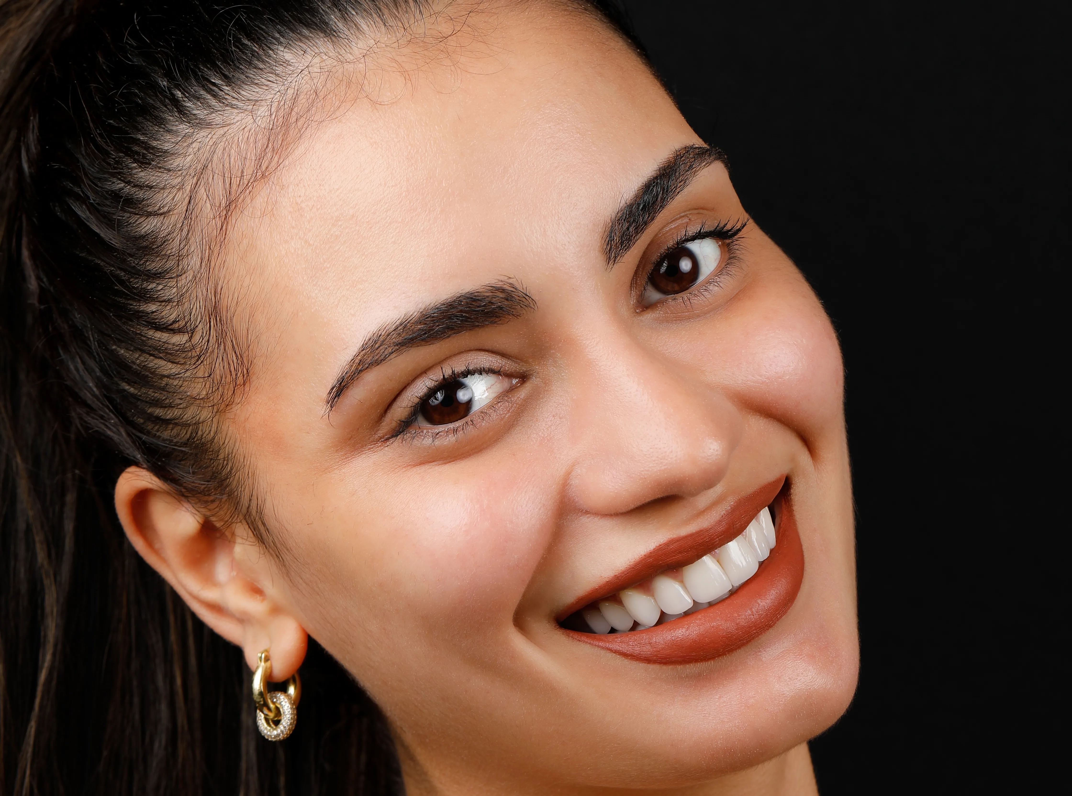 Smile Design photo